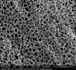 一种自组装凝胶祛痘微针贴片及其的制备方法和应用